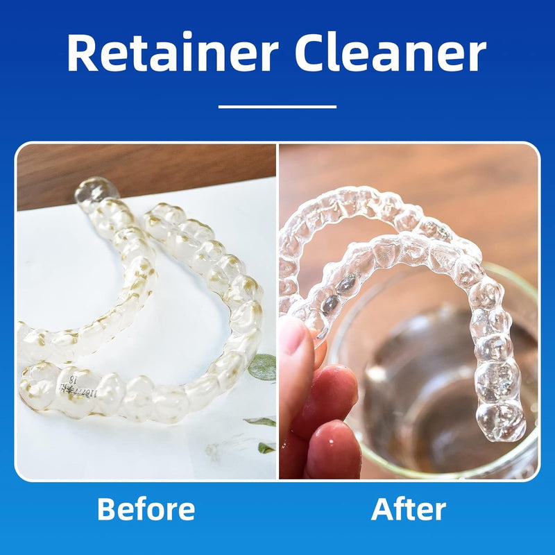 [Australia] - Retainer Cleaner Tablets for Dental Appliances and Night & Mouth Guard, Denture Cleaning Tablets Solution to Offer Confident Smile.(150 Tablets,Mint Flavor) 150 Count (Pack of 1) 