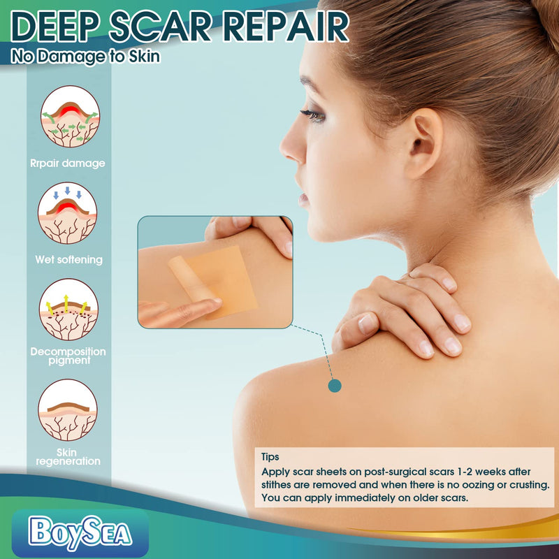 [Australia] - Professional Silicone Scar Sheets (1.6" x 150" Scar Roll-3.8M) - Scars Removal Treatment - Reusable Silicone Scar Tape Strips Type for Keloid, C-Section, Surgery, Burn, Acne et Natural 