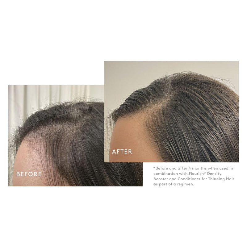 VIRTUE Flourish Sulfate Free Shampoo for Thinning Hair, Volumizing Hair Growth Product, Detoxifies and Repairs, Color Safe 8 Fl Oz (Pack of 1)