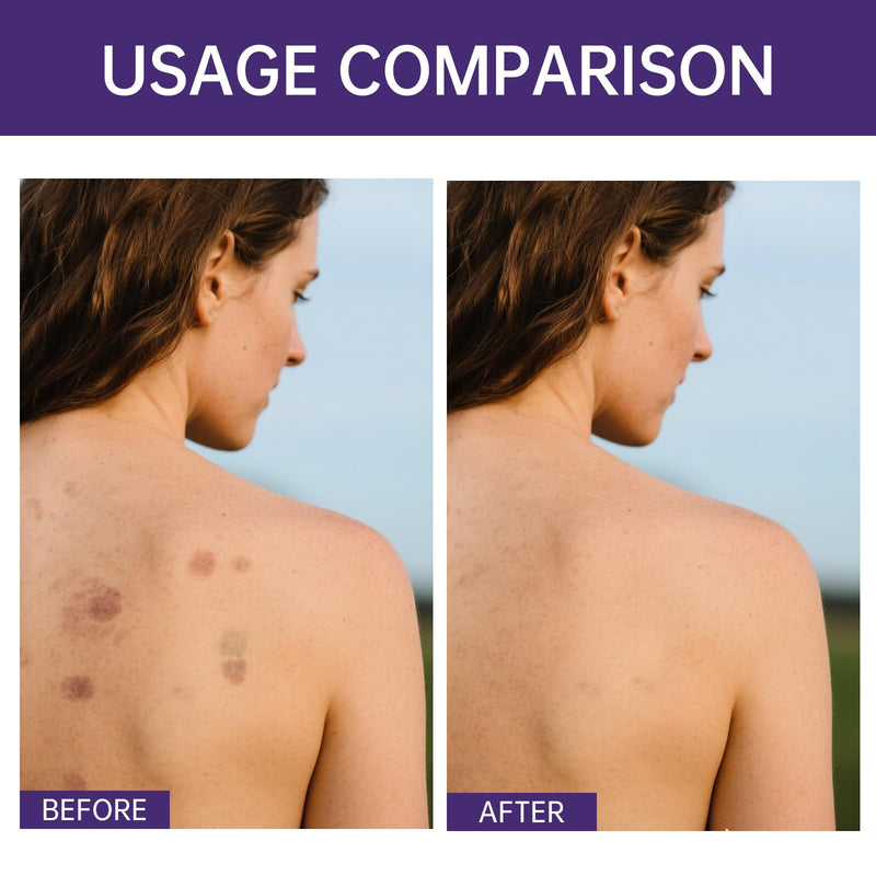 [Australia] - Body Coverage Perfector, Waterproof Leg & Body Makeup for Tattoo & Scar Cover Up, No Transfer Coverage Concealer with Brush, All Over Complexion Perfector for All Skin Tones (Natural Radiance) Natural Radiance 