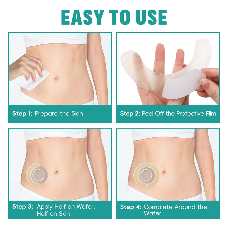 [Australia] - 40 PCS Ostomy Barrier Strips,Ostomy Supplies,Elastic Hydrocolloid Waterproof Leak - Skin Adhesive Ostomy Barrier Tape for Colostomy Stoma Bags 40 Pcs 