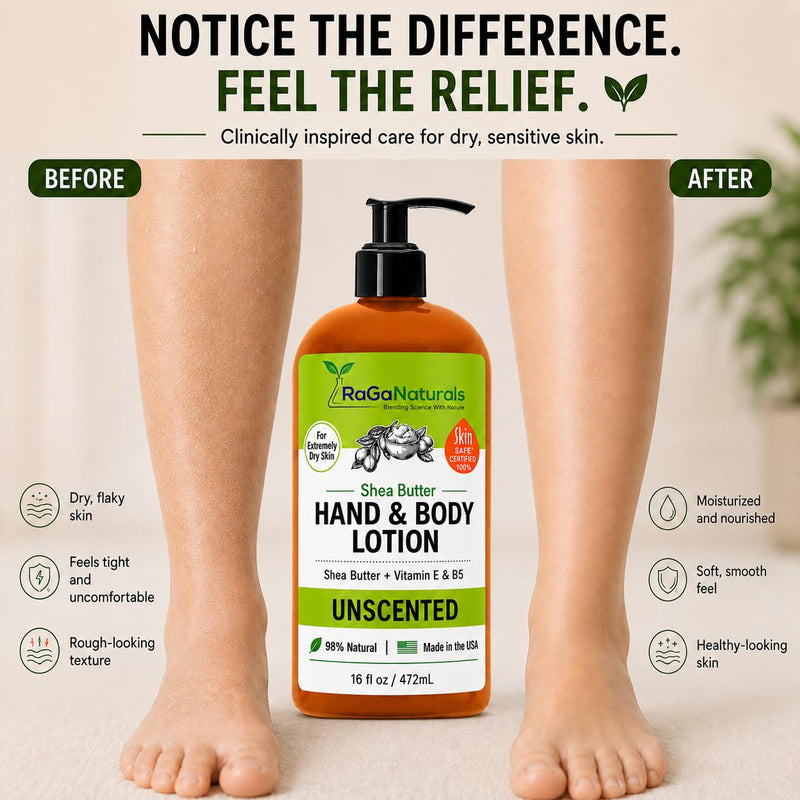 RaGaNaturals Unscented Shea Butter Lotion - for Extremely Dry Skin - Hand & Body Lotion - Hydrating Natural Non-Toxic Formula, Avocado Oil & Vitamin E, Fragrance Free - Women, Men, Kids & Baby - 16 Oz 16 Fl Oz (Pack of 1)