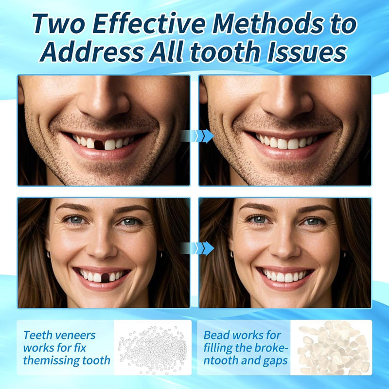 Tooth Repair kit for Filling The Missing Broken Tooth and Gaps-Moldable Fake Teeth and Thermal Beads Replacement Kit-Natural Color-BB1