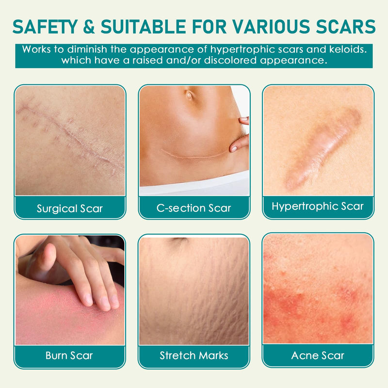 [Australia] - Silicone scar plaster, silicone plaster for scars, silicone scar tape roll, scar roller, surgical scars, silicone scar sheets for visible scar care (4 cm x 300 cm) 