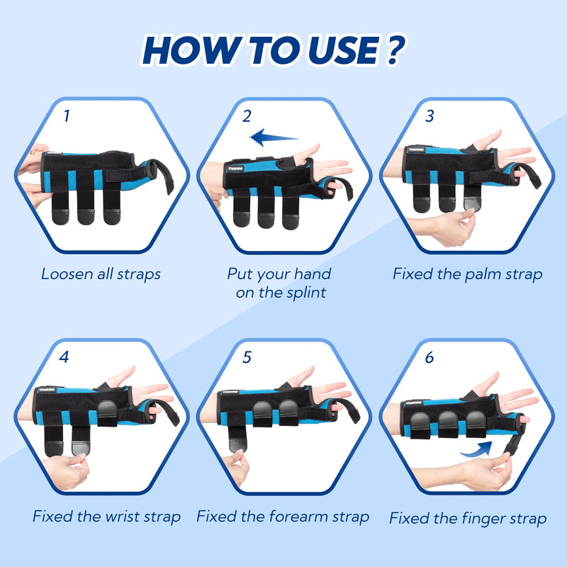 Boxer Fracture Splint, Ulnar Gutter Splint Right Hand, the 4th and 5th Metacarpal Finger Splint Hand Brace, Boxer Orthosis Hand & Wrist Brace for Women & Men, Left, L