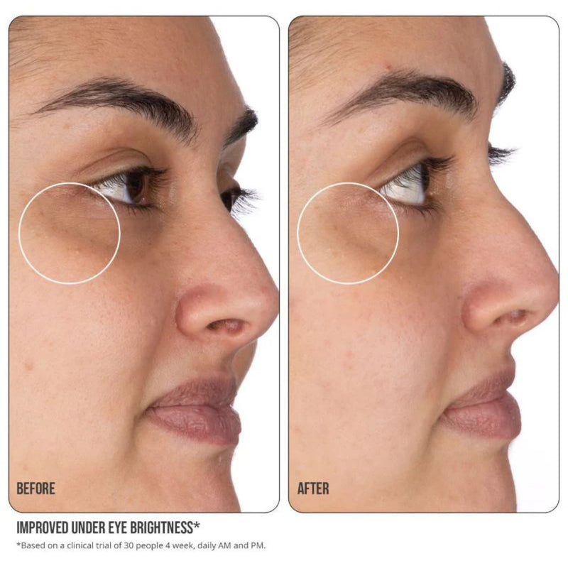 Nip+Fab Vitamin C Fix Eye Cream 10% 0.5 fl oz | with Peptides, Caffeine and Niacinamide for Smoother, Brighter Under Eye Skin | 3 Forms of Vitamin C