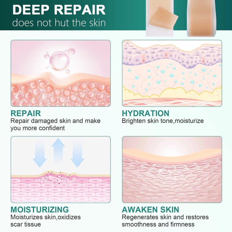 [Australia] - Silicone Scar Sheets,Silicone Scar Tape(1.6"x 120" Roll-3M), Reusable and Effective Scar Removal Sheets, Silicone Scar Removal Sheets for Surgical Scars,Healing Keloid, C-Section, Tummy Tuck 1.6"x 120" Roll 