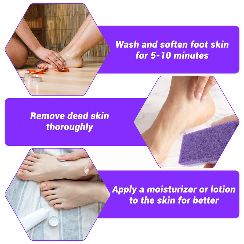 [Australia] - JJUNW Pack of 5 Pumice Stone for Foot Care, Double-Sided Pumice Stone Foot Care Callus Remover and Scrubber for Hard Skin on Feet and Body, Exfoliating and Smoothing the Skin (Purple) Purple 