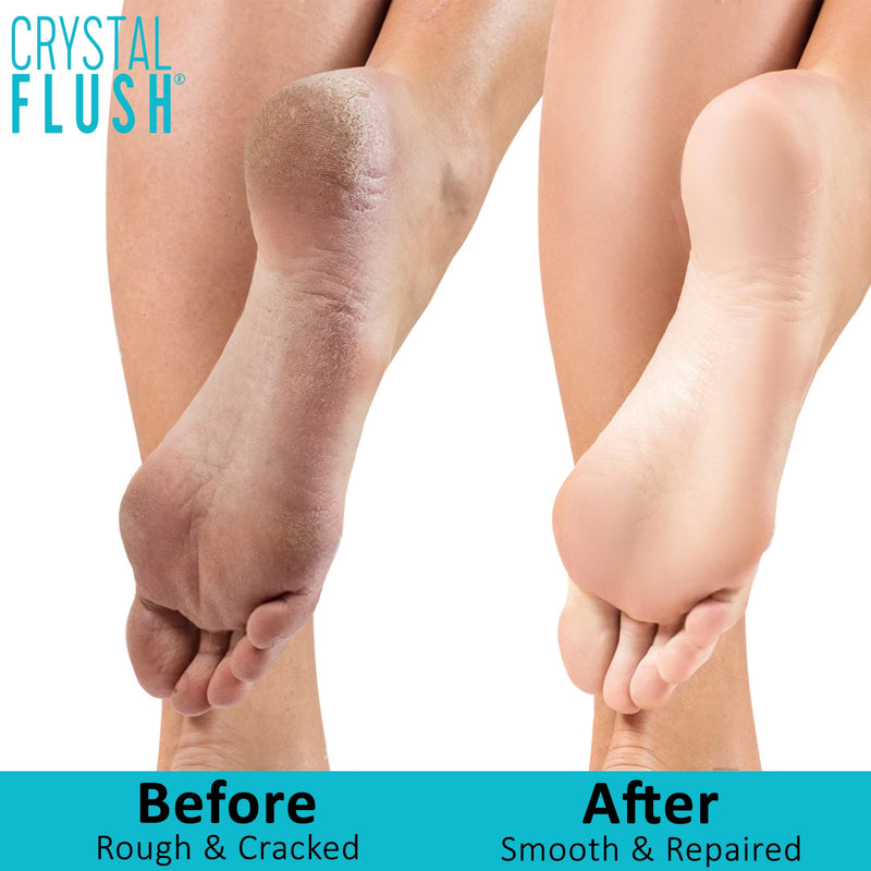 [Australia] - Foot Soak with Apple Cider Vinegar, Tea Tree Oil & Pink Himalayan Salt – Deodorizes 16 oz - Discover More About Our Complete 2-Step Anti-Fungal Solution & Related Skincare Tips by Visiting us Online 