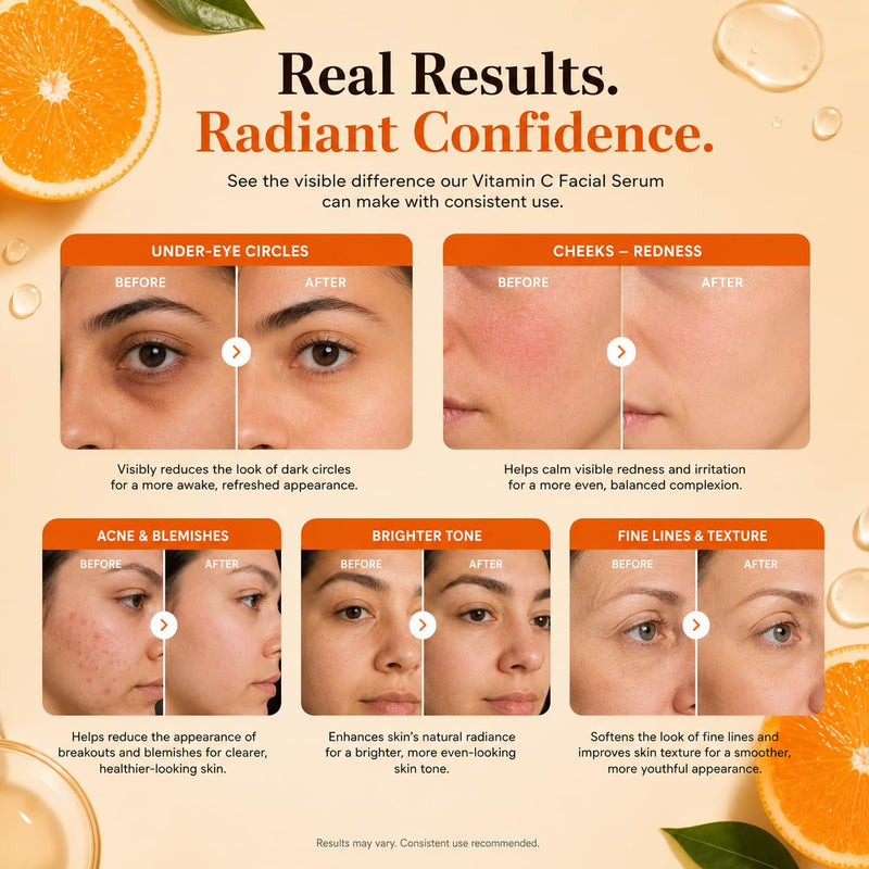 AuraLife Vitamin C Face Serum with Hyaluronic Acid, Vitamin E & Aloe Vera – Brightening & Hydrating Facial Serum for Dark Spots, Fine Lines, Wrinkles & Uneven Skin Tone – 1 Fl Oz (Facial Serum)