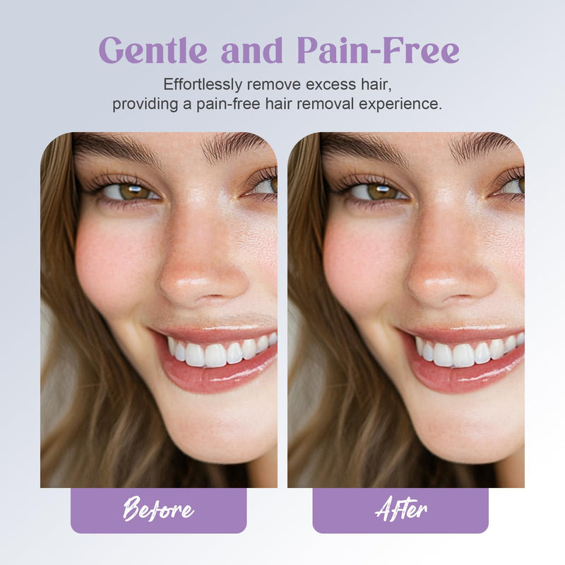 Battery Powered Facial Hair Remover for Women Lips, Chin, Neck, and Cheeks - Gentle and Pain with 2-pc Replacement Heads and 1 Battery 2 Heads+Purple(Battery) 4
