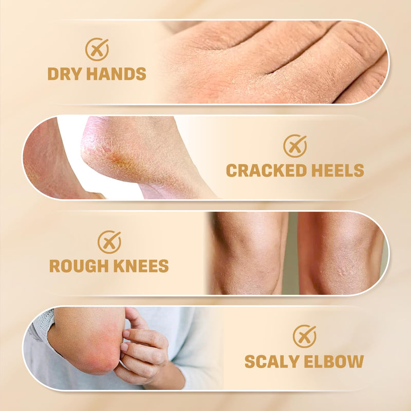 2Pack 60% Urea Cream for Feet & 2% Salicylic Acid for Deep Hydration-300g | Urea Cream 60 Percent for Feet & Hands-Maximum Strength Moisturizer for Rough,Dry,Thick & Cracked Skin,Callus Remover 5.29 Ounce (Pack of 2)