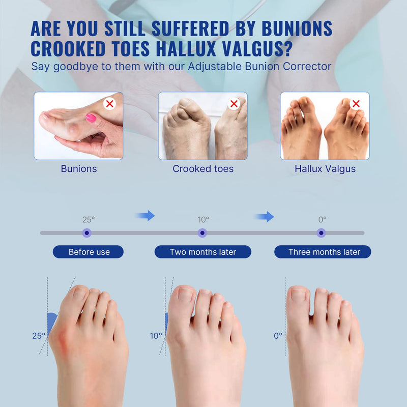 [Australia] - Fitgeno Bunion Corrector Women & Men Big Toe: Foot Straightener Splint Brace - Adjustable Bunyan Correction Orthopedic for Hallux Valgus Pain Relief 2 Pcs Black 