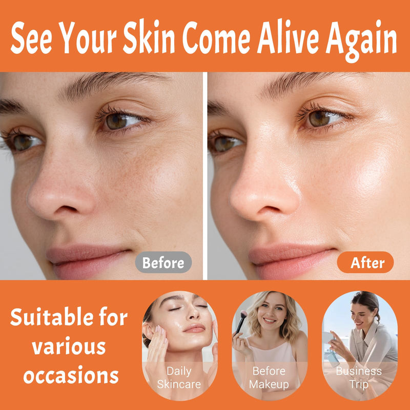 Vitamin C Serum – Brightens, Evens Tone, Hydrates, and Smooths | Anti Aging Serum with Hyaluronic Acid & Vitamin E – for Improving of Dark Spots, Fine Lines & Wrinkles – All Skin Types