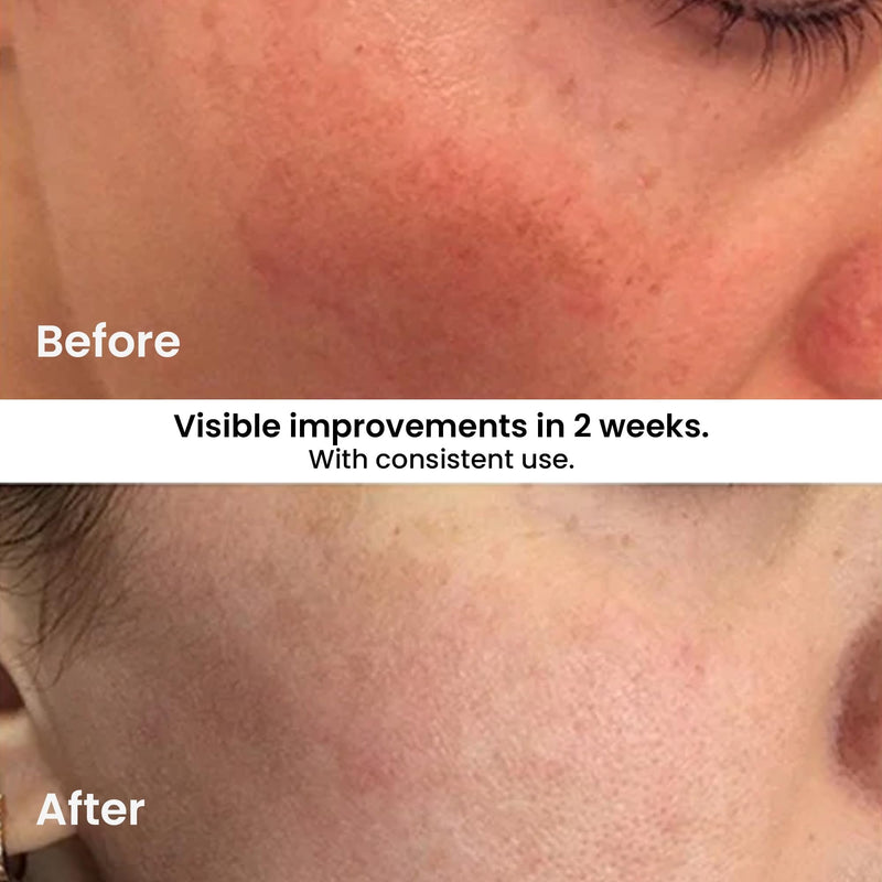Kleem Vitamin C Serum for Face - Anti-Aging & Brightening - 1.7 oz | Illuminates dull skin & diminishes dark spots for a healthy, glowing complexion. Cruelty Free, EWG Verified & Made in the USA 1.7 Fl Oz (Pack of 1)