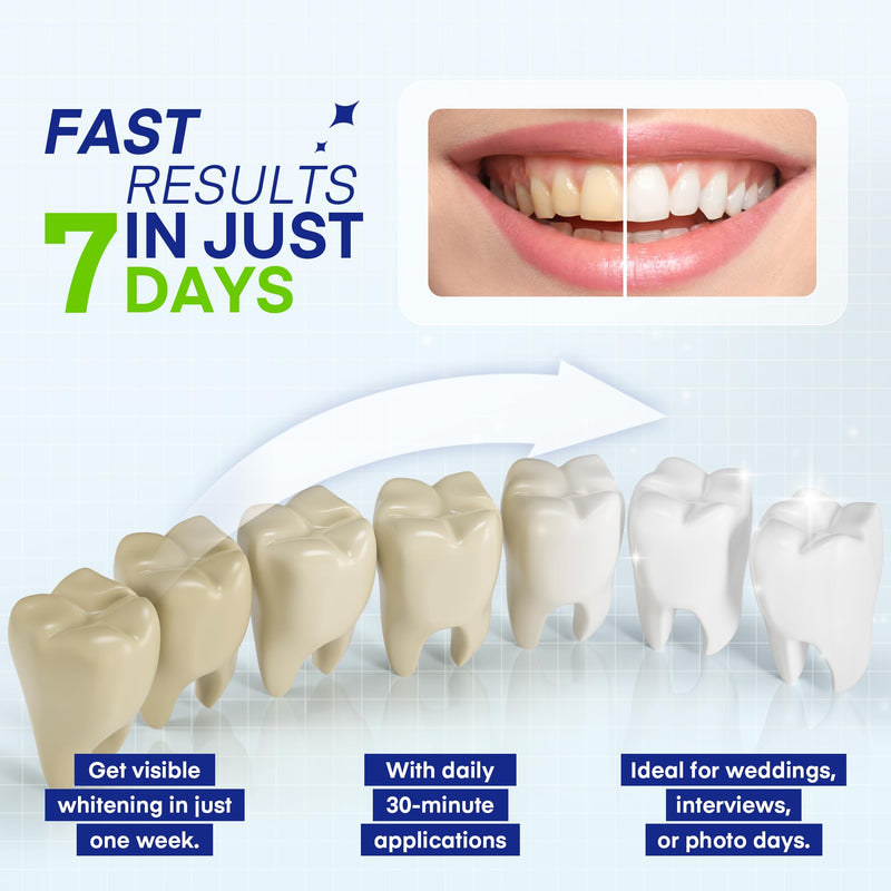 Teeth Whitening Pen – 35% Urea Peroxide Gel, Clear Twist-Dispensing Whitening Pens for Stain Removal, Professional-Strength, Easy-to-Use, Travel-Friendly(A Set of 5 Pens) 0.07 Fl Oz (Pack of 5)