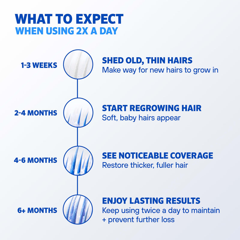 Men's Rogaine Extra Strength 5% Minoxidil Solution, 1 Mo Supply, 2 Fl Oz Solution Topical Treatment (1-Month Supply)