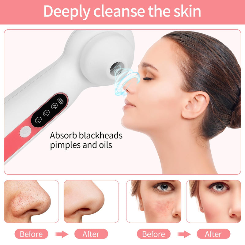 Visual Blackhead Remover Vacuum,3 Adjustment Modes & 3 Silicone Nozzle Blackhead Extractor, Pore Cleaner LED Magnifier, Professional Black Head Extractions Tool, No APP Connection Required.