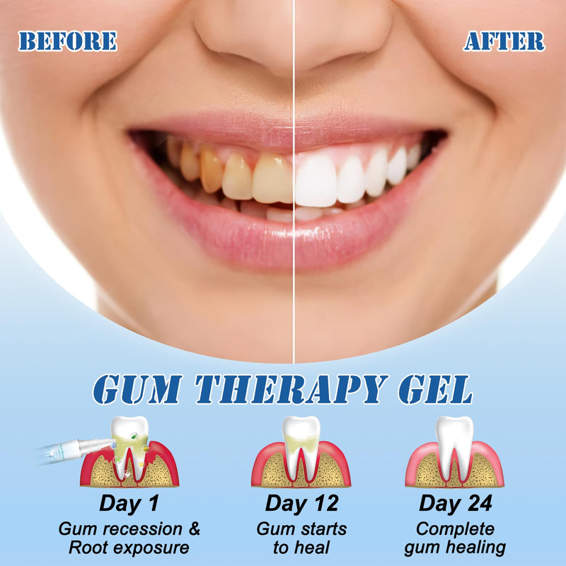 [Australia] - Neslemy™ Gum Shield Therapy Gel, Neslemy Gum Gel, Dentizen Gum Therapy Gel, Teeth Whitening Essence Pen, Gum Instant Treatment Gel, pack of 3 A 