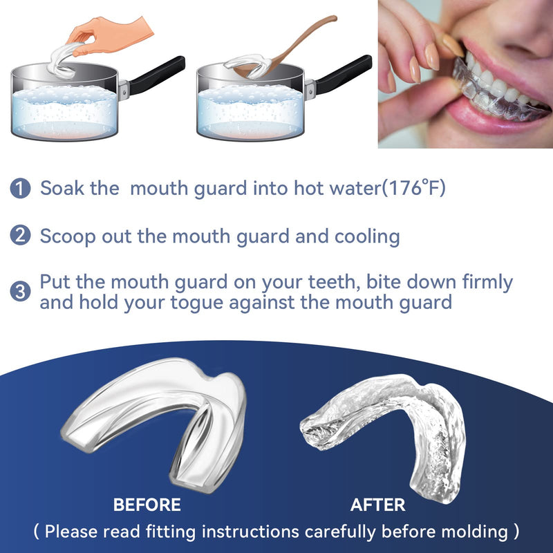 [Australia] - 4 Pack Kids Mouth Guards for Teeth Grinding, Small Size, Comfortable Night Guard for Kids, Professional Mouth Guards, Effective for Clenching Teeth 