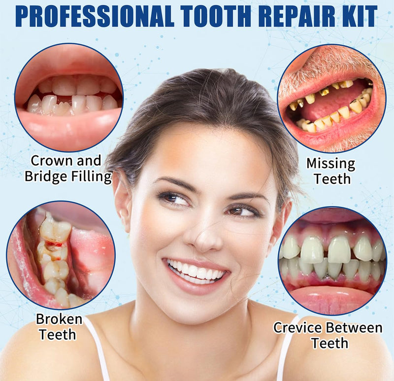 Broken Tooth Repair Kit, Zinc Oxide Eugenol Cement Dental Care Kit, Temporary Fixed Crown and Bridge 2 Packs 1