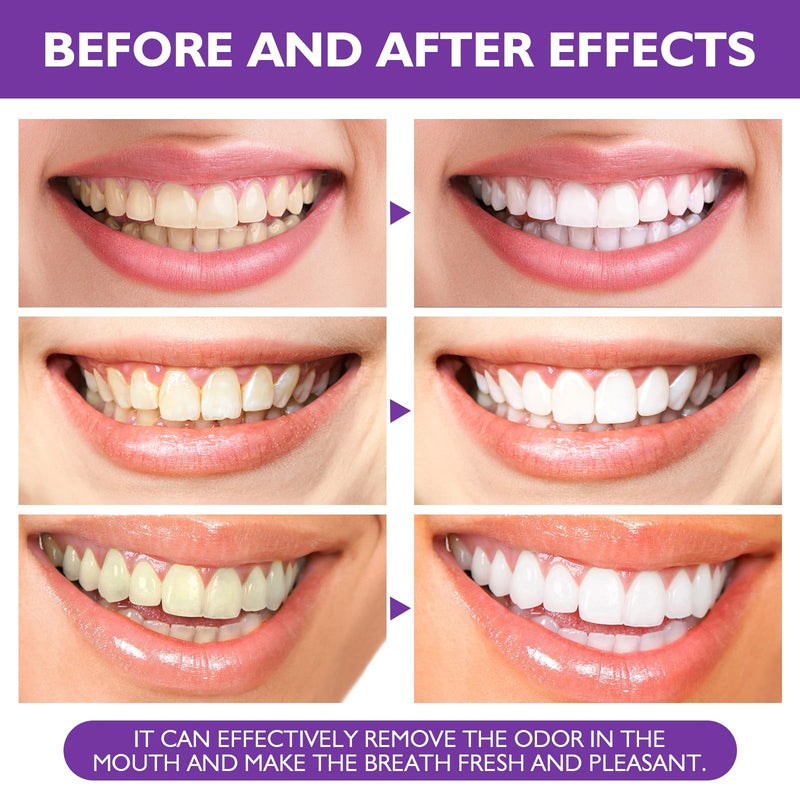 2PCS Purple Toothpaste for Teeth Whitening, Purple Toothpaste Whitening Booster, Tooth Stain Removal Colour Corrector, Stubborn Stain Removal & Enamel-Safe Brightening