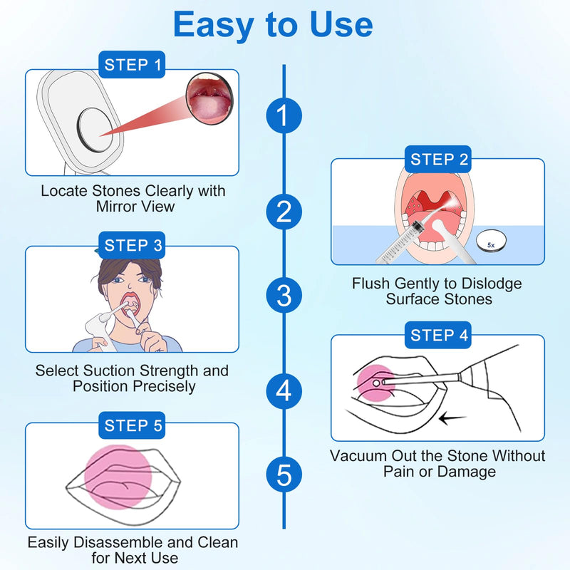 [Australia] - Tonsil Stone Remover Tool, Upgraded Electric Tonsil Stone Removal Kit - with Built-in LED Light & 6-Level Suction for Bad Breath Prevention, Oral Suction Device for Stone Removal White 