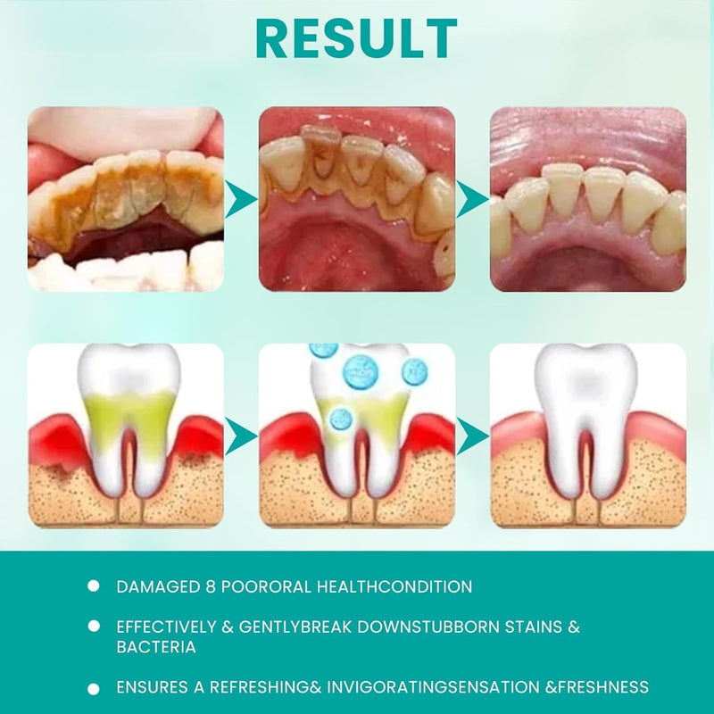 2pcs Sp6 Probiotic Whitening Toothpaste, Sp 6 Toothpaste, Sp-6 Ultra Whitening, Fresh Breath