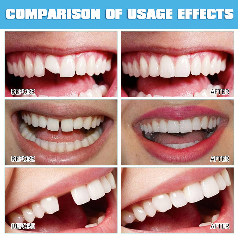 [Australia] - 100g clip-on teeth, dentures, temporary teeth, tooth repair set, do-it-yourself dentures, with 4 tools, for repairing missing and broken teeth with prosthetic veneers 