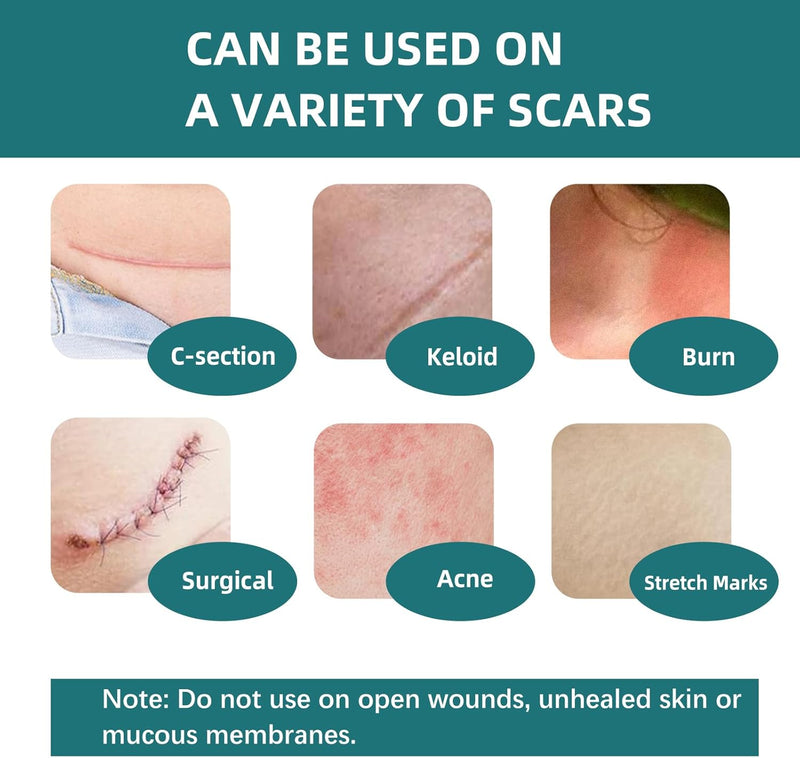 [Australia] - Silicone Scar Sheets, Silicone Scar Tape(1.6”x 60” Roll-1.5M), Silicone Scar Strips, Professional Scar Removal Sheets for Surgical Scars, Keloid, C-Section, Burn et 