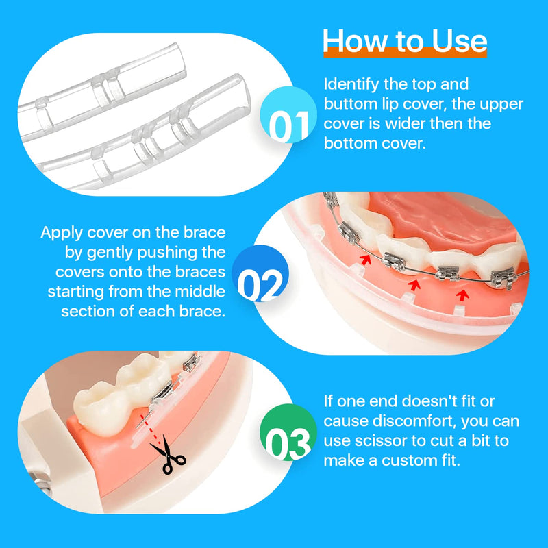 [Australia] - AIM Clear Lip Protector for Braces with Carry Case – Comfort Covers, Wax Alternative, Trim-to-Fit Teeth Shield (Upper + Lower) 
