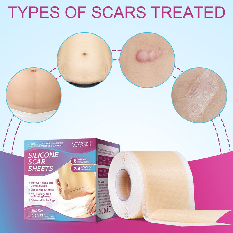 [Australia] - Silicone Scar Sheets,Silicone Scar Tape Roll,Soft Silicone Tape for Scar Removal,Reusable Waterproof Professional Scar Treatment Patch for C-Section,Keloids,Surgical,Acne (Roll Size 1.6''x75''-1.9M) Roll Size 1.6''x75'' 