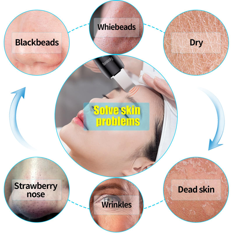 [Australia] - Facial Skin Cleanser with Mister, Upgraded Sprayer, Blackhead Extractor for Deep Cleansing and Moisturizing Spray 