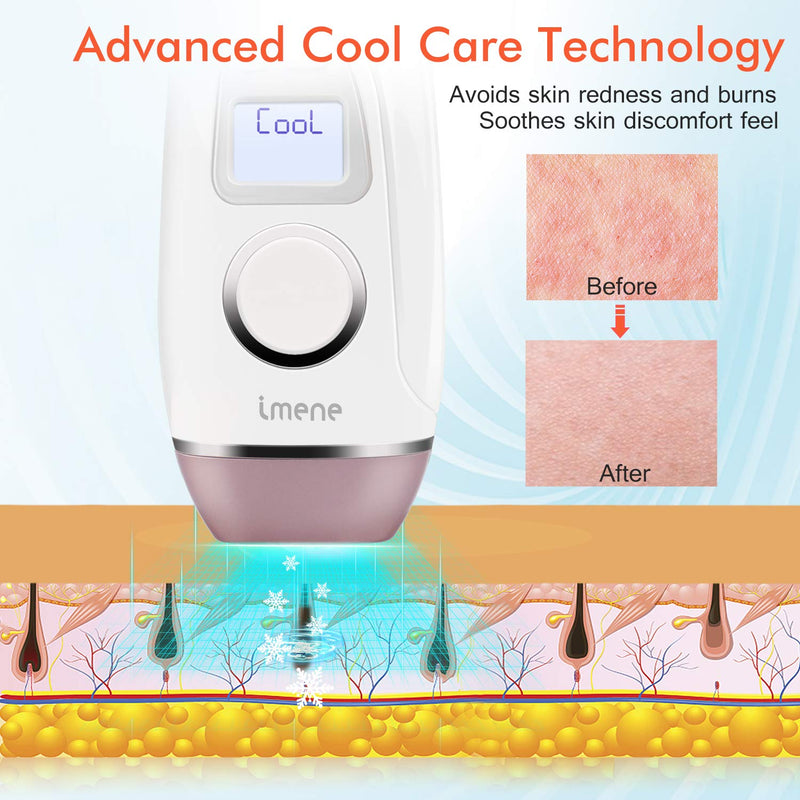[Australia] - IMENE Permanent Hair Removal Machine for Women & Men, 500,000 Flashes IPL System with Ice Care Function for Full Body Home Use - Safest and Fastest IPL Technology 
