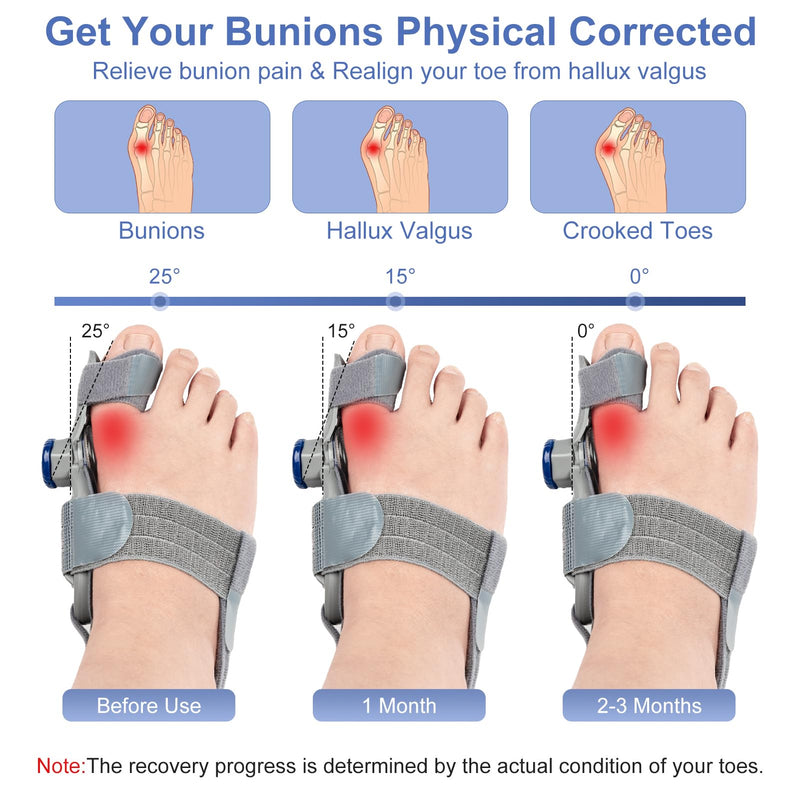 [Australia] - Bunion Corrector for Women & Men, Orthopedic Bunions Correction,Adjustable Bunion Splint Suitable for Left/Right Feet Bunion Relief (Grey) Grey 