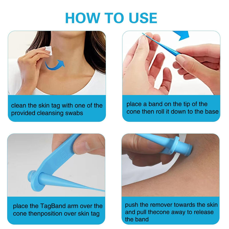 [Australia] - Tag Remover Device, Stalk Wart Removal Device, 3 in 1 Skin Tag Fibroma Removal Quick Kit, Safe for Face, Neck and Body Azure Blue 