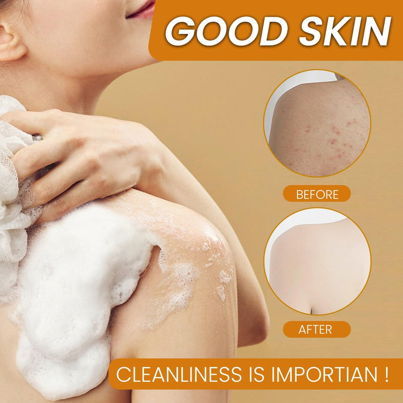 Jabon de Curcuma para Las Manchas, Crema para Manchas Oscuras en La Cara | Jabón para La Cara, Jabón de Cúrcuma Con Vitamina C para Cara y Cuerpo, Piel Hidratante de Piel Sensible Soap, 100g 3 PCS