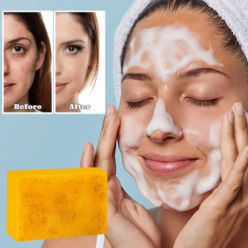 Jabon de Curcuma para Las Manchas, Crema para Manchas Oscuras en La Cara | Jabón para La Cara, Jabón de Cúrcuma Con Vitamina C para Cara y Cuerpo, Piel Hidratante de Piel Sensible Soap, 100g 2 PCS