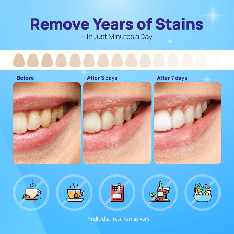 [Australia] - Whitebite Pro Upgraded Teeth Whitening Strips 14 Strips (7 Treatments) | Enamel-Safe | Deep Stains Removal | Non-Slip Design | Whitening Without Any Harm | Mint 14 Count (Pack of 1) 