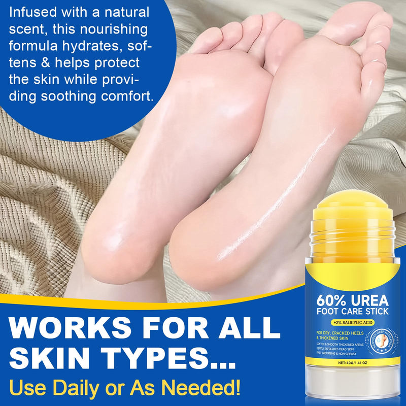 60% Urea Cream Stick plus 2% Salicylic Acid, Maximum Strength Urea Foot Cream Callus Remover for Dry Cracked Heels, Hands, Knees,Exfoliating Moisturizer, Dead Skin Remover Foot Balm 1.4oz (2pcs) 1.41 Fl Oz (Pack of 2)
