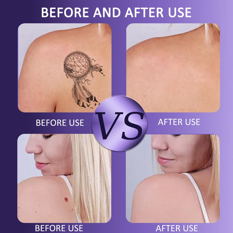 [Australia] - Leg Makeup Waterproof - Coverage for Scars & Blemishes, No Transfer, Lightweight & Long-Lasting, Natural Radiance (01) 01 