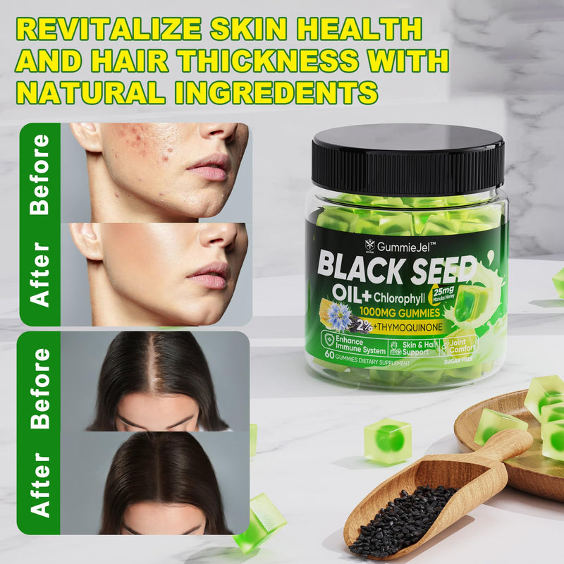 [Australia] - Black Seed Oil Gummies & Chlorophyll, Biotin 500mcg with Hydrolyzed Collagen, Raw Manuka Honey, Organic Cold Pressed - Ultimate Absorption for Skin, Hair & Nails Health, Digestive, Joint, Sugar Free 