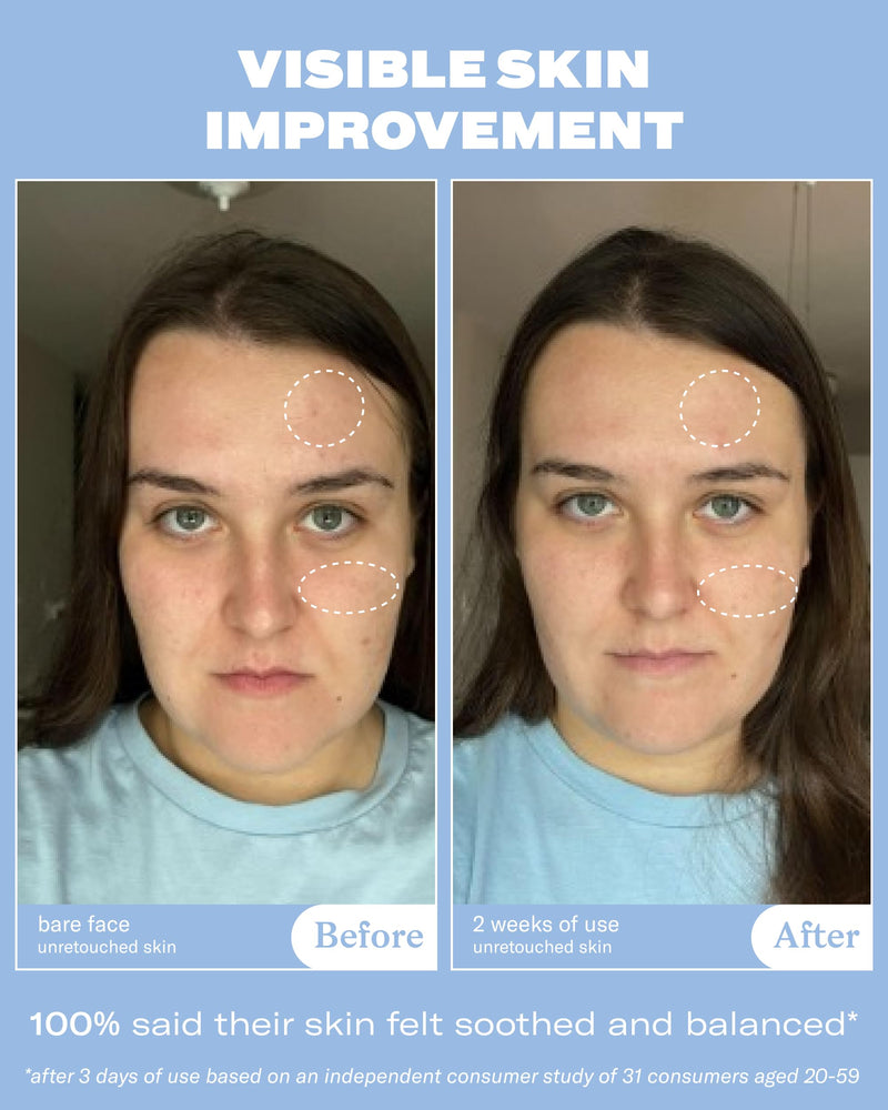 Then I Met You Renewing Rich Beauty Cream, Korean Skin Care Moisturizer | Barrier Cream With Ceramides, Omega 3, & Vitamin E. Panax Ginseng Smooths Wrinkles And Hyaluronic Acid And Squalane Hydrate