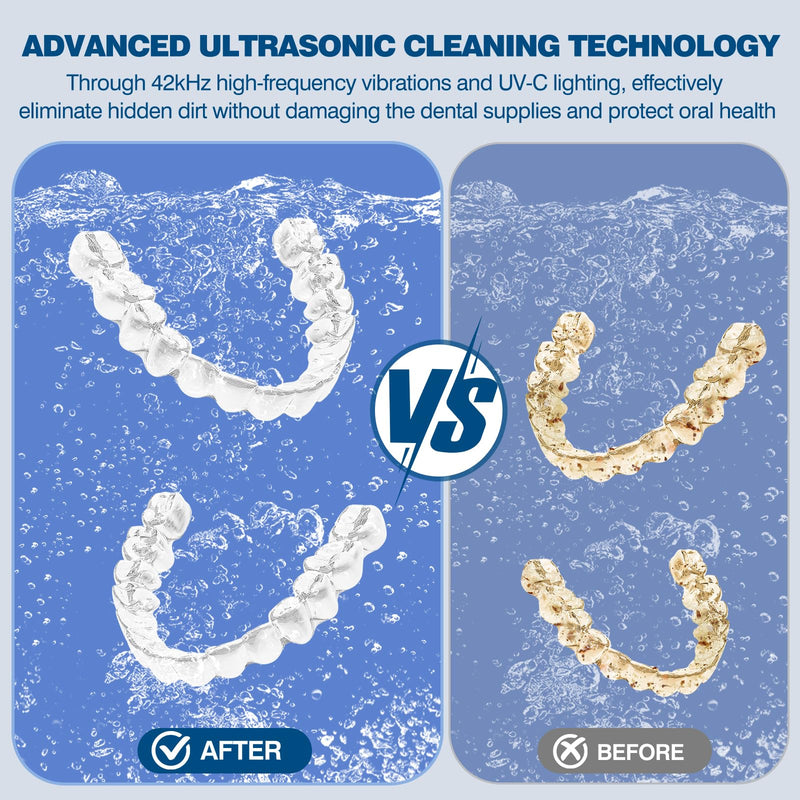 [Australia] - Dental Ultrasonic Retainer Cleaner Machine: 42KHz 28W 180ml,Dental Cleaning Pod for Dentures, Aligners & Mouthguards 