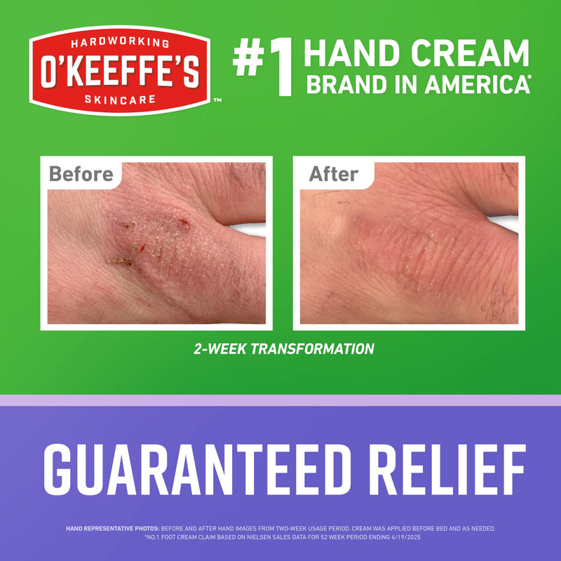 O'Keeffe's Working Hands Night Treatment Hand Cream, 7 oz Tube | Repairing Skincare for Cracked, Dry Hands, Hypoallergenic, Non-Greasy Formula, & Unscented 7 Ounce (Pack of 1)