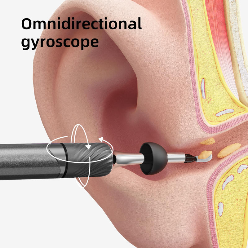 [Australia] - Earwax Remover, Electric Ear Cleaner Removal with LED Light, Ear Cleaning Camera Otoscope with Light Endoscope Camera for Adults and Children Pets Black Black 