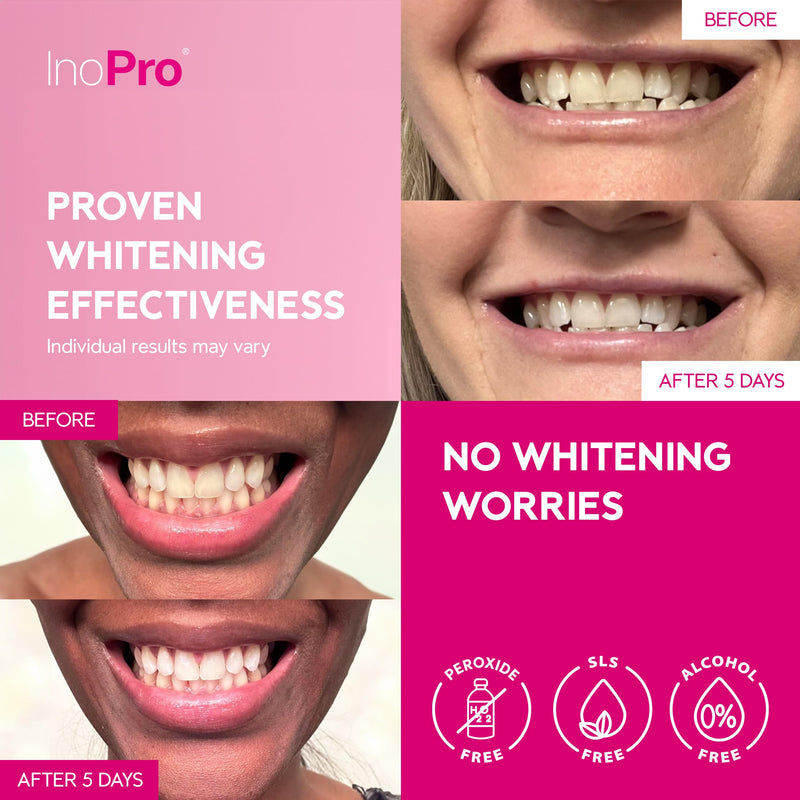 [Australia] - Teeth Whitening Strips 14 Treatments - Peroxide Free - Whitening Without The Harm - Deep Stains Removal - Whitening for Sensitive Teeth - 28 Strips 28 Count (Pack of 1) 