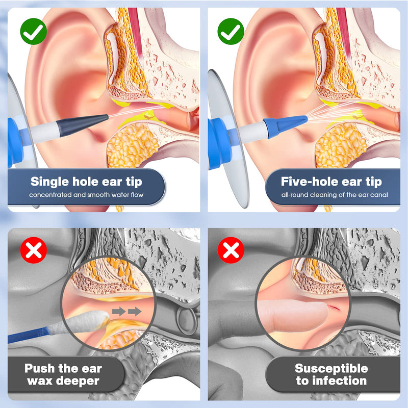 [Australia] - Ear Wax Removal, Electric Ear Cleaning Kit with Light, Ear Irrigation Kit with 4 Pressure Modes, Safe and Effective Ear Flush Kit with Ear Cleaner - Includes Basin, Towel & 15 Tips Blue 