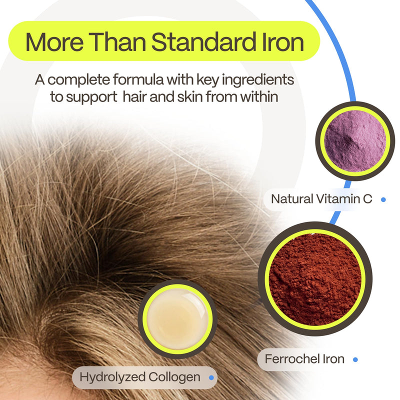 DermaIRON Iron Supplement for Women & Men – Gentle Iron for Low Ferritin & Anemia Support, Hair Thinning & Hair Loss Support, with Collagen & Vitamin C 60 Count (Pack of 1)