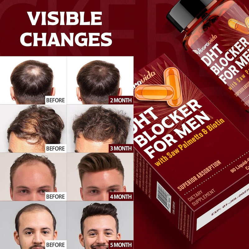 DHT Blocker for Men | Hair Growth Supplement with Saw Palmetto & Biotin - Hair Growth Vitamins - Hair Regrowth - Natural Hair Loss Supplements Liquid-Filled - Proprietary Herbal Blends (90 Capsules) 90 Count (Pack of 1)